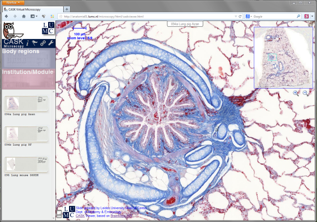 CASK Virtual Microscopy Viewer