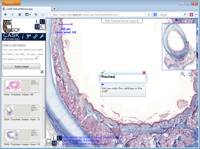 Online labelling in CASK Virtual Microscopy Viewer